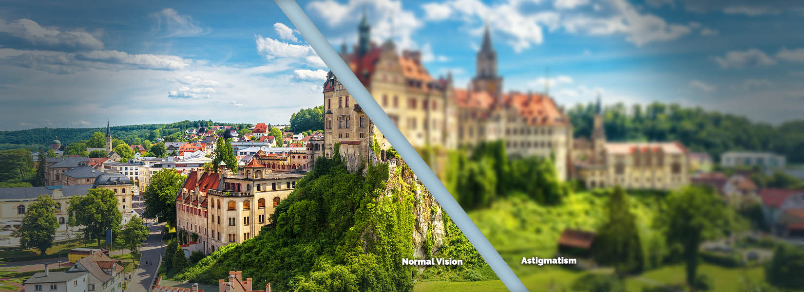 Astigmatism Treatment in Blaine