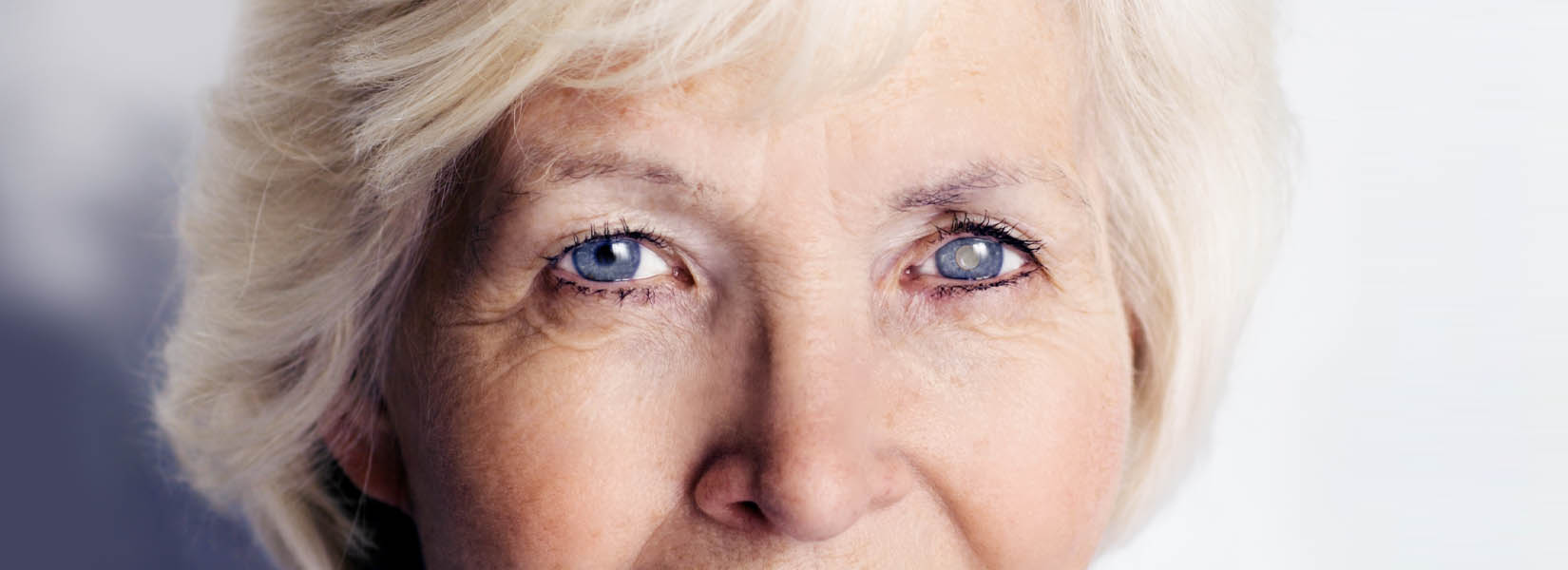 Cataract Surgery in Blaine